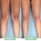 Versatile Joint Massager