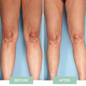Versatile Joint Massager
